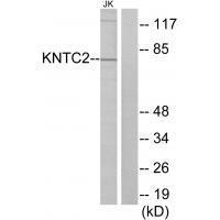 KNTC2 Antibody