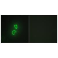 TNF11 Antibody