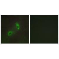 HGS Antibody