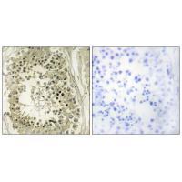 HGS Antibody