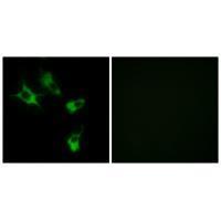 MAST4 Antibody