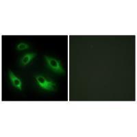 EPHB6 Antibody