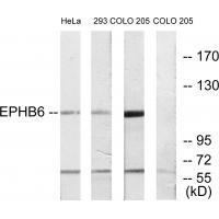 EPHB6 Antibody