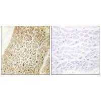 AKAP8 Antibody
