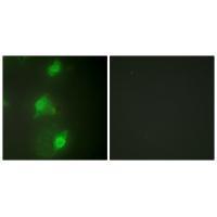 AIRE Antibody