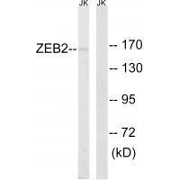 ZEB2 Antibody