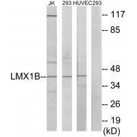 LMX1B Antibody