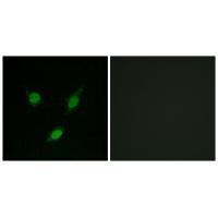 TACC1 Antibody