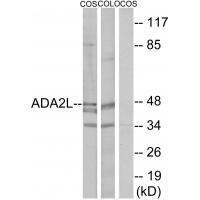 ADA2L Antibody