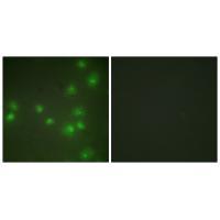 ZNF265 Antibody