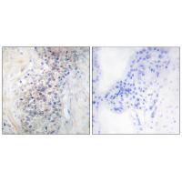 LRAT Antibody