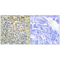 TFIP8 Antibody