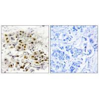 MAP3K6 Antibody