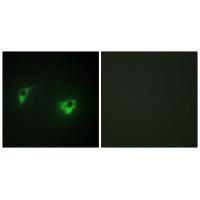 MEKKK 4 Antibody