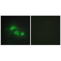 KAD1 Antibody