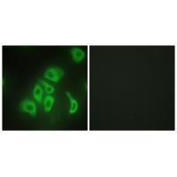 TNFA Antibody