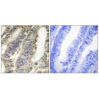 TNFA Antibody