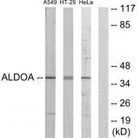 ALDOA Antibody
