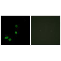 HMG17 Antibody