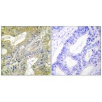 HEXB Antibody 