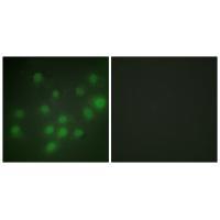 HKR1 Antibody