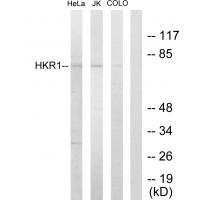 HKR1 Antibody