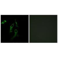 HARS Antibody