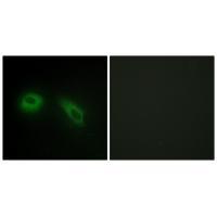 GLU2B Antibody