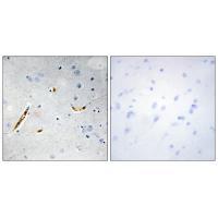 TCF3 Antibody