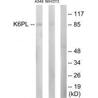 K6PL Antibody