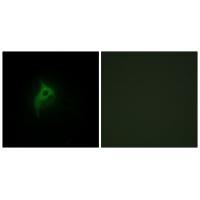 Adrenergic Receptor alpha-2B Antibody