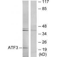 ATF3 Antibody