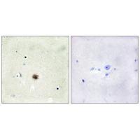 CRP1 Antibody
