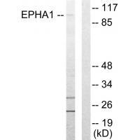 EPHA1Antibody