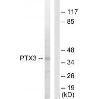 PTX3 Antibody