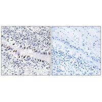 ZNF76 Antibody