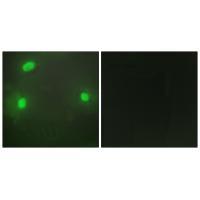FEN1 Antibody