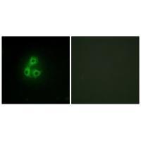 CSK Antibody