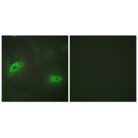 TNFSF9 Antibody 