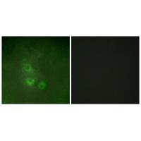FRK Antibody