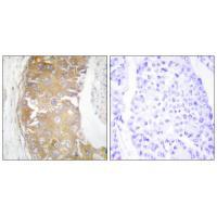 FRK Antibody