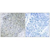 ETV4 Antibody