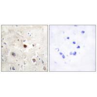 p57KIP2 Antibody