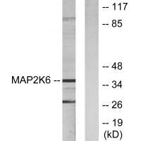 MAP2K6 Antibody