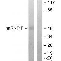 hnRNP F Antibody