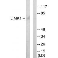 LIMK1 Antibody