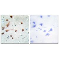 ADAR1 Antibody