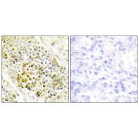 DLX5 Antibody