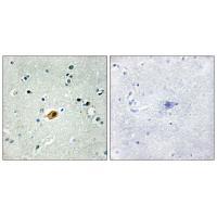 SOX8/9/17/18 Antibody