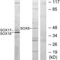 SOX8/9/17/18 Antibody